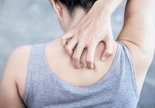 不要错把艾滋病当皮肤病,身体若存在3变化,或是艾滋病发出信号