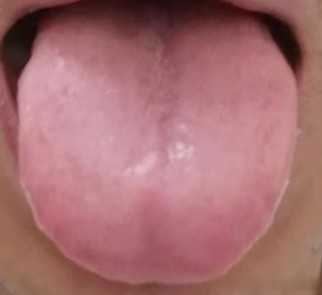 这个经方可调海绵体发育不良