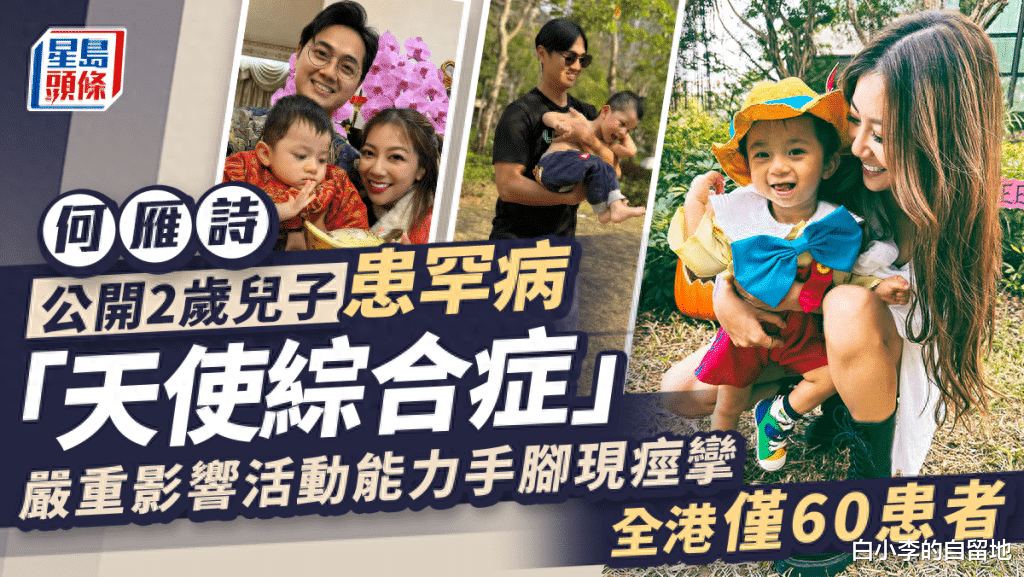 TVB男星自曝2岁儿子患罕见病！发育迟缓严重影响生活，计划生二胎