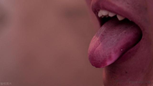 “上有虚热,下有真寒”的上热下寒症,有3种情形,第3种很常见