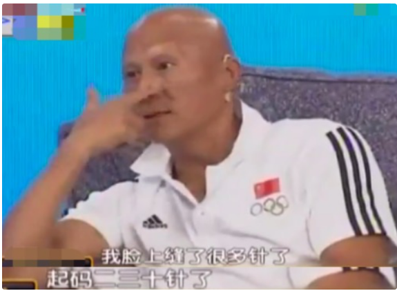 林志颖“生父”、李连杰“死对头”，17岁中毒毁容，如今怎样了?