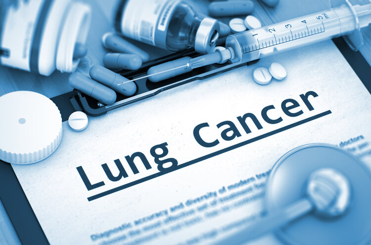 肺癌大户被揪出！世卫组织：致肺癌能力仅次于吸烟，你家可能就有