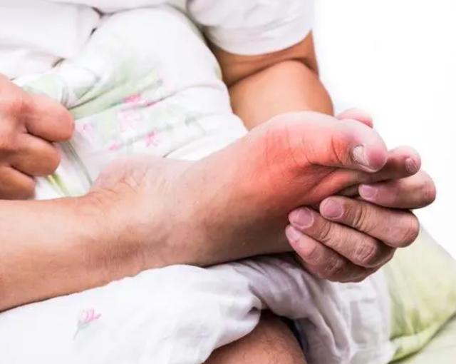 49岁女子尿酸高达380!医生:不想靠透析过活,千万忌口3种蔬果