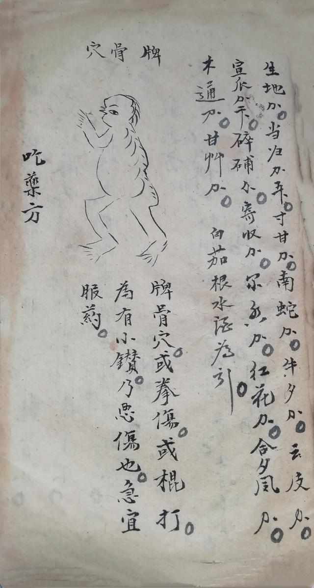 跌打损伤伤穴位秘方古书籍