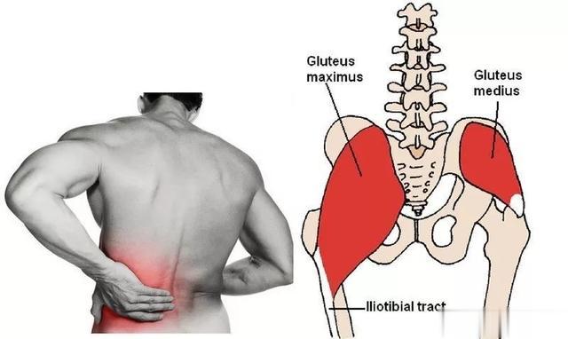 腰痛、膝盖痛何需要练臀中肌，它有什么作用，如何训练？