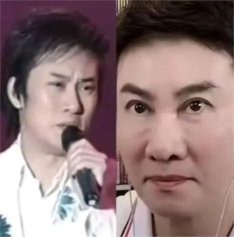 “宁愿丑得出奇”也不接受自然衰老,这10位男神已经面目全非