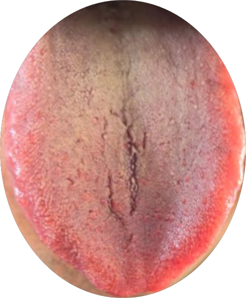 这三个地方通了，宗筋又强又有力，让你重回巅峰状态！