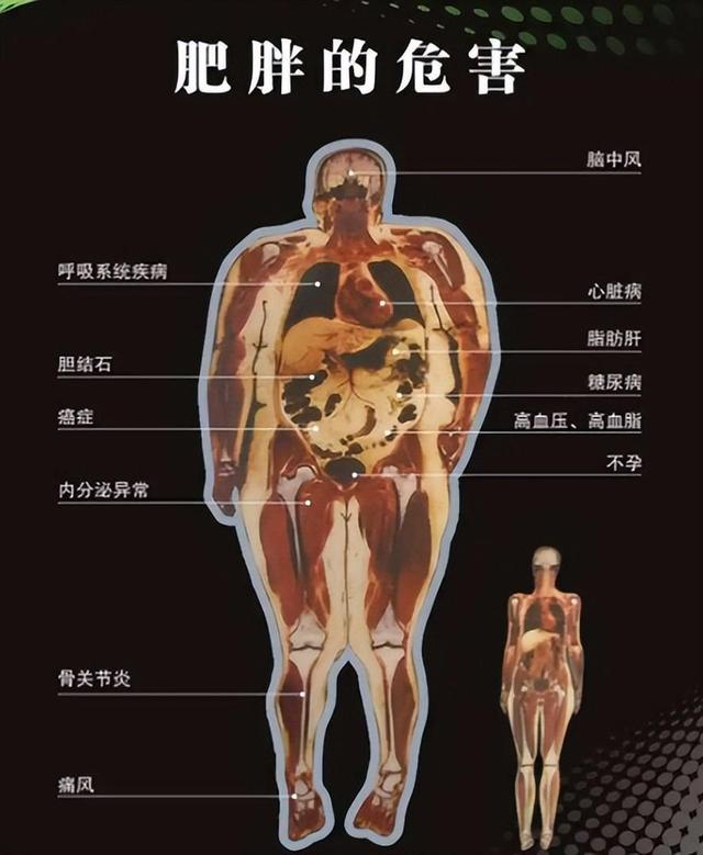 校花婚后被喂到330斤，生育困难，丈夫：不准她减肥 怕被别人抢走