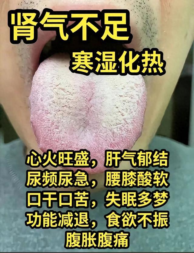 潘医生舌诊—实战分析：肾气不足，肾阳不足，肾阴不足