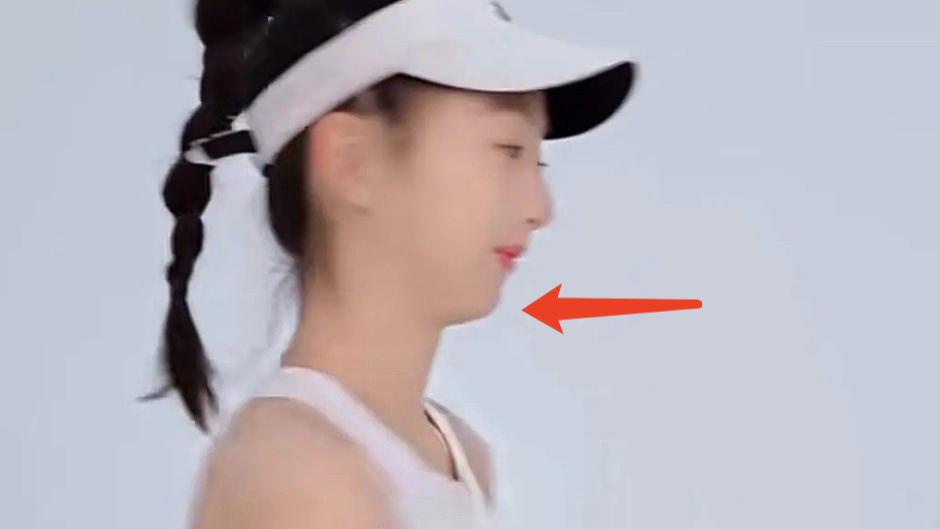 17岁森碟变化大，下巴后缩明显错过最佳矫正期，田亮夫妇再遭质疑