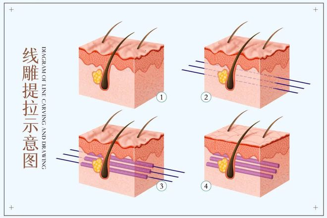 陈文学院长分享分层抗衰是什么？为什么要分层进行抗衰？