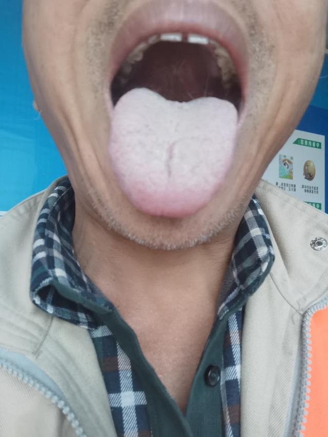 湿气重，还在拿参苓白术散当宝贝？这两招才能将湿气连根拔起！