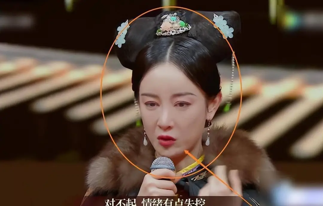 我的天，她也去整容了?