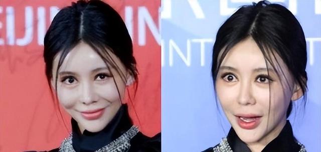 “宁愿丑成怪物”也要永葆青春，这8位明星早已整的“惨不忍睹”