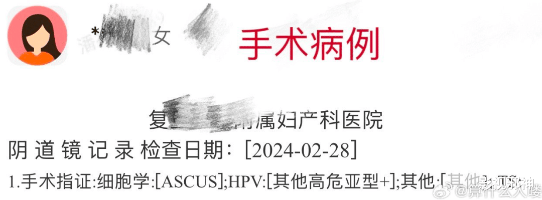 这瓜，好恐怖啊！