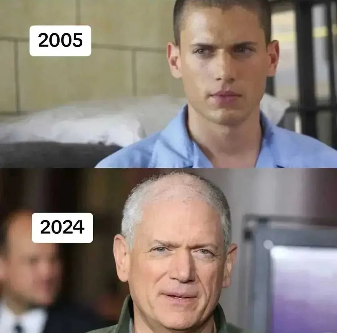 《越狱》主演米帅近照曝光，头发稀松全白满脸沧桑，网友叹青春不再