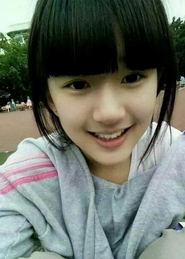 赵露思代言照又变脸了!笑容脸僵眼睛睁不开,网友呼吁别再医美了