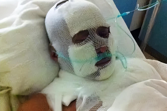 歌手陈少华:因拒绝给伴舞签名,被砍掉下巴毁容,沦落卖马桶谋生