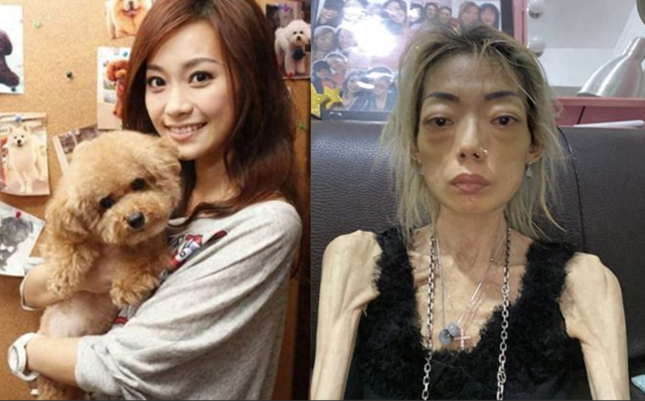 嫁入豪门八年被抛弃,牙齿掉光胃被切除瘦成皮包骨,伍智恒后悔吗