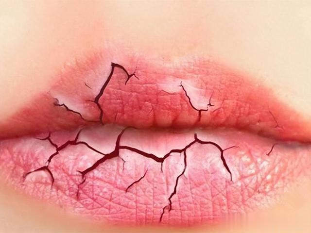 一吃饭就满头大汗，你以为在排毒？其实是这三种原因导致的！