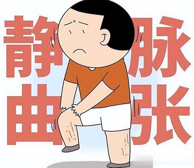 静脉曲张不用慌，张仲景的一张小方，打通血管，化掉一身瘀血