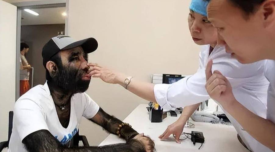 当年轰动一时的“毛孩”：42岁娶90后小娇妻，生一子有无遗传？