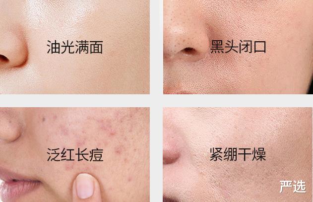 脸上刚“打湿”就涂洗面奶，难怪洗完也出油，皮肤越来越粗糙