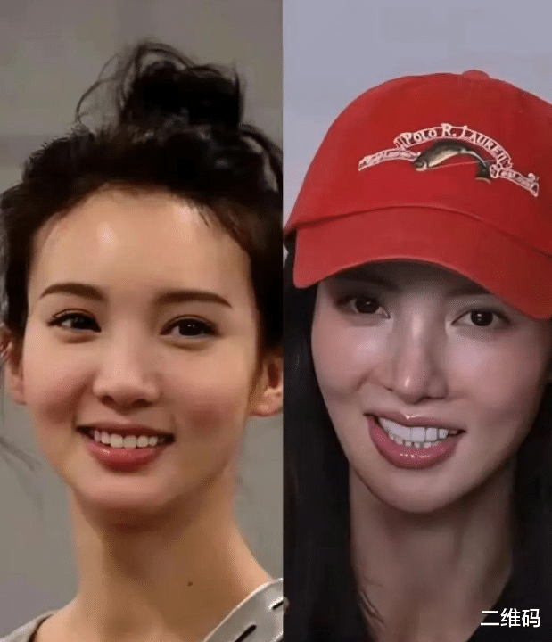 金晨整容传闻引热议:从清纯偶像到尖鼻女神,这波操作值吗?