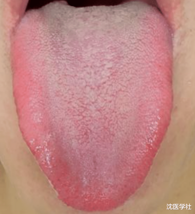 肝气一通，失眠无踪！3个药，疏肝、清肝、养肝！赶走失眠早醒