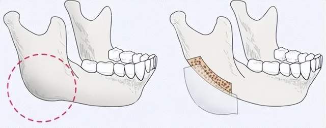 张元英和IU生了个女儿?直播狂捞32亿,居然还被肥猪方时赫截胡了