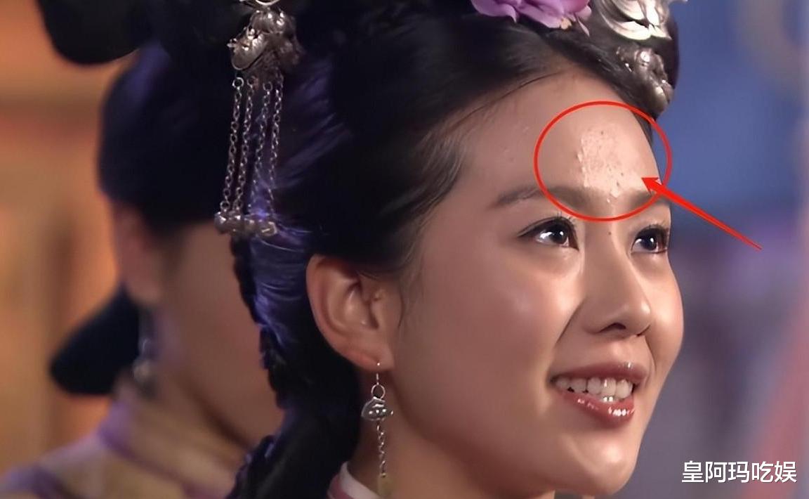 沈梦辰的黑,李沁的斑点,没了滤镜生图下的明星“暴露”了