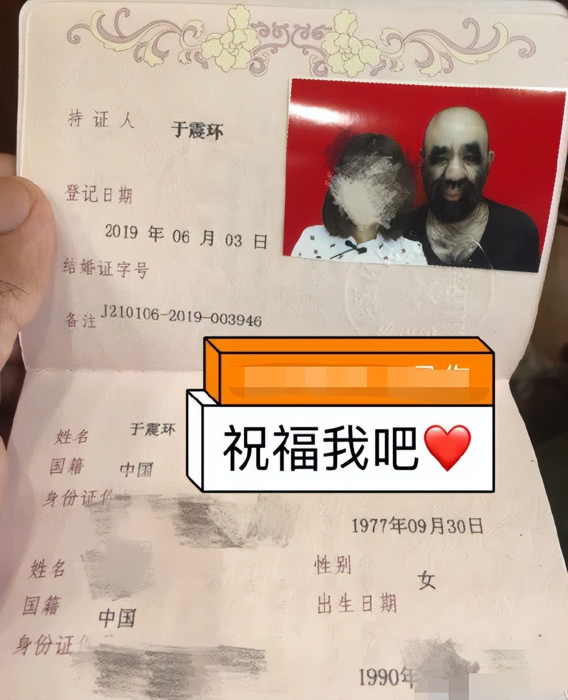 当年轰动一时的“毛孩”：42岁娶90后小娇妻，生一子有无遗传？