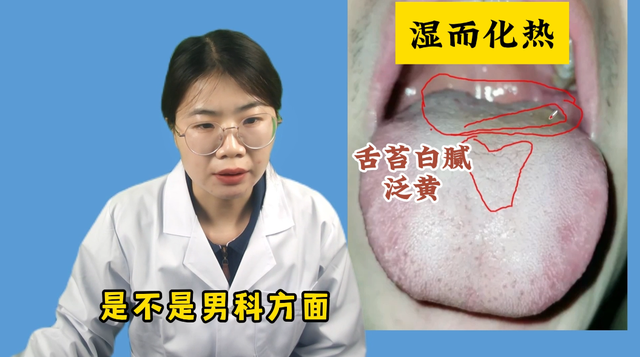 潘大夫舌诊：舌苔白腻白腻的，像是铺了一层粉，这个人体内太寒了