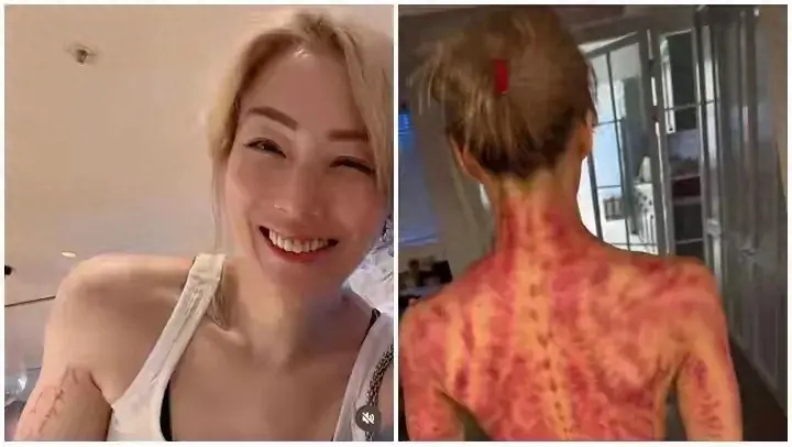 对许志安执迷不悔？瘦到脱相的郑秀文让女人清醒：爱情经不起考验