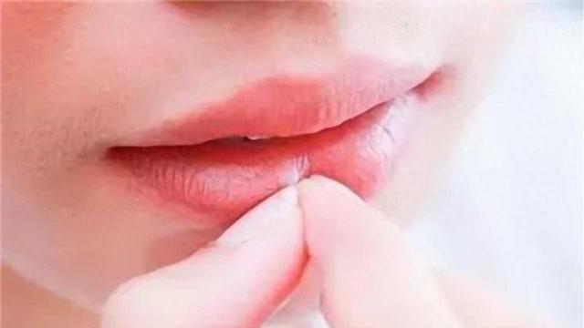 嘴唇有2个迹象，血脂或已超标，这是真的吗？听听医生怎么说