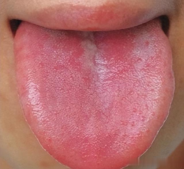 人体常见八大体质，阴虚、阳虚、血瘀、痰湿、上热下寒，你是哪种