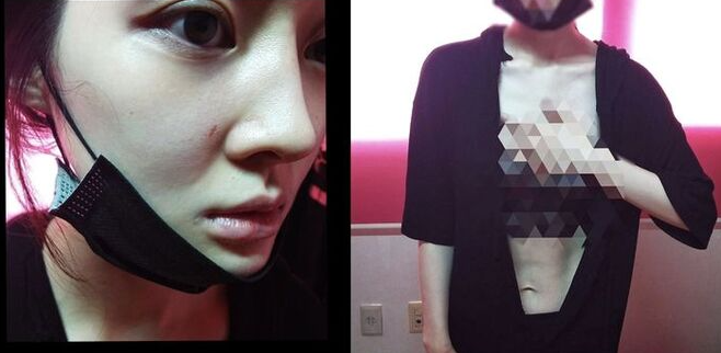 韩女星李雅凛家中自杀获救但昏迷不醒，曾多次控诉前夫家暴