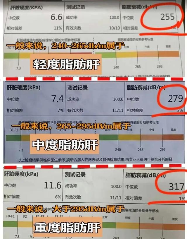肝硬度检查肝脏的“硬度”“弹性”，4类人不建议做这项检查！