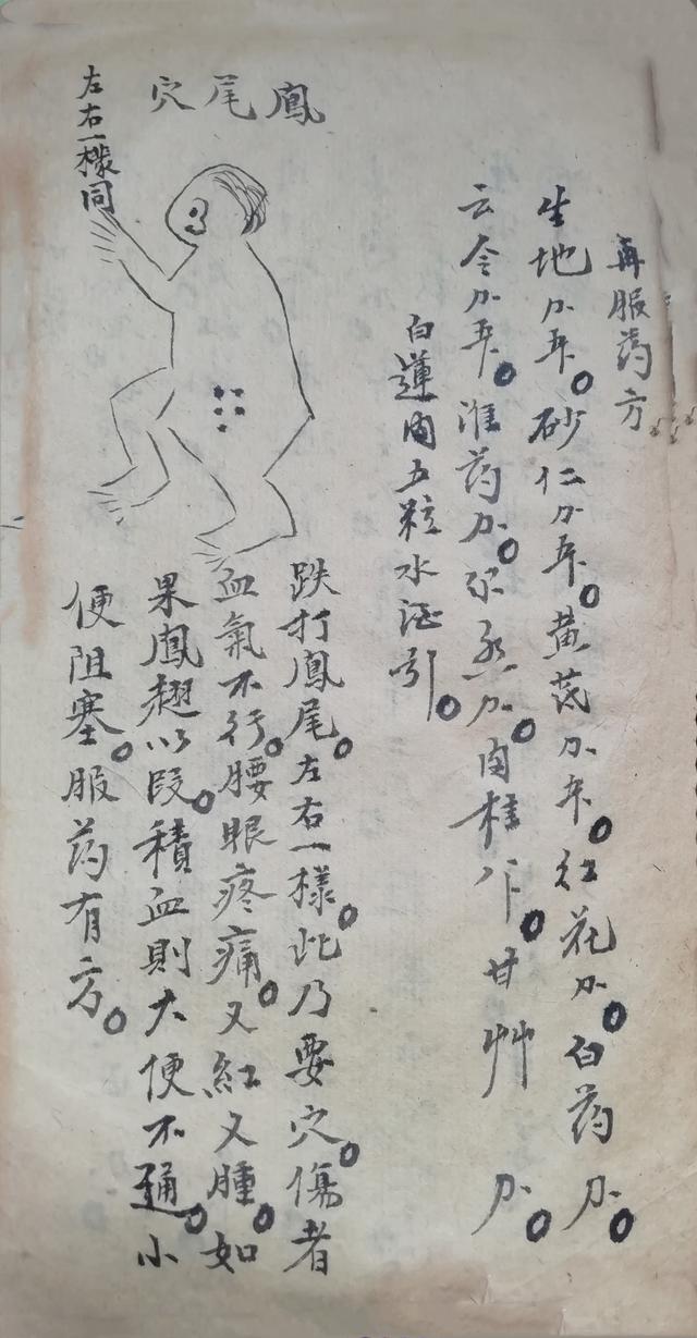 跌打损伤伤穴位秘方古书籍