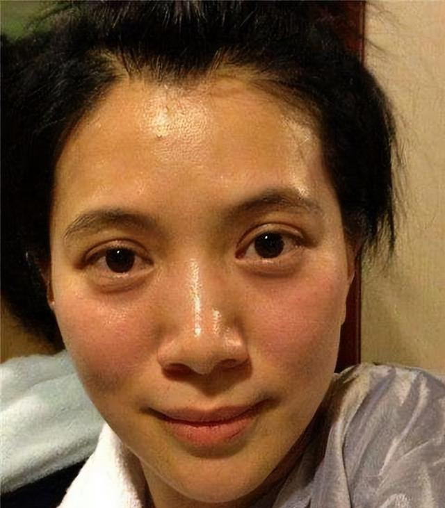 明星无滤镜真可怕，陈慧琳似张飞，戚薇像老太，赵丽颖对比太惨烈