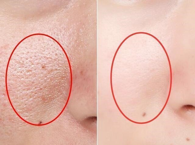 那些正慢慢毀掉您皮膚的護(hù)膚謠言，北大醫(yī)生：亂用真的會(huì)毀容！