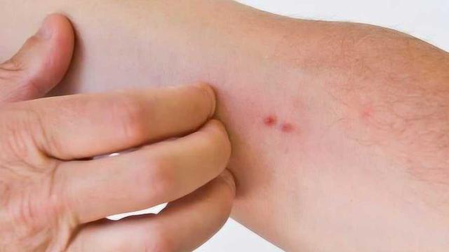 身上这位置有红点，或是癌症前兆，不要以为只是过敏