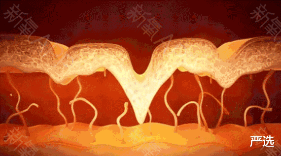 那些尝试“美容针”的女人,如今变成什么样了?过来人说出心里话