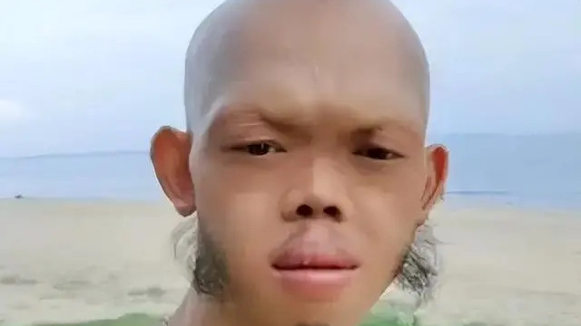 “妖魔专业户”李平安：长相怪异却抱得美人归，癞蛤蟆吃到天鹅肉