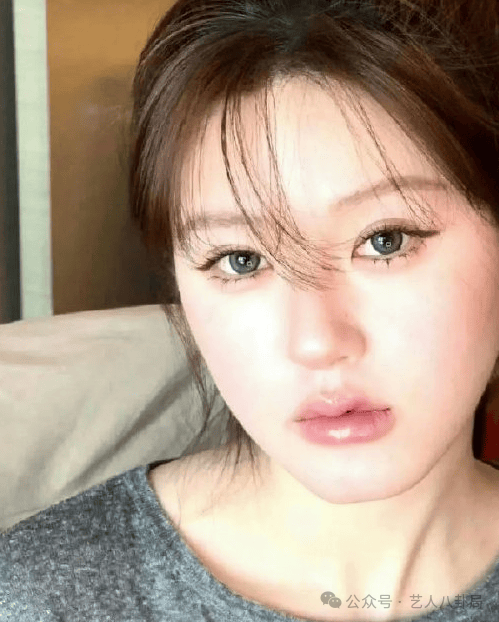 赵露思宝格丽生图嘘声一片，人瘦脸肿如大变活人，腋下太脏好尴尬