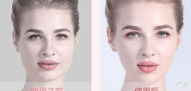 那些尝试“美容针”的女人,如今变成什么样了?过来人说出心里话