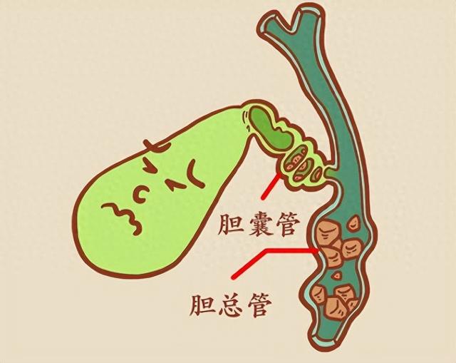 每天敲打胆经100下，打通身体的阳气通道，还能预防胆结石！