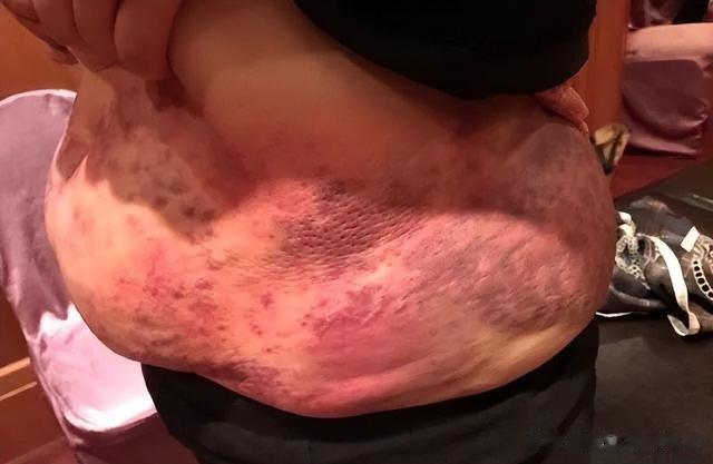 夏天，“拍打腹部”竟然可以缓解这么多慢性病！