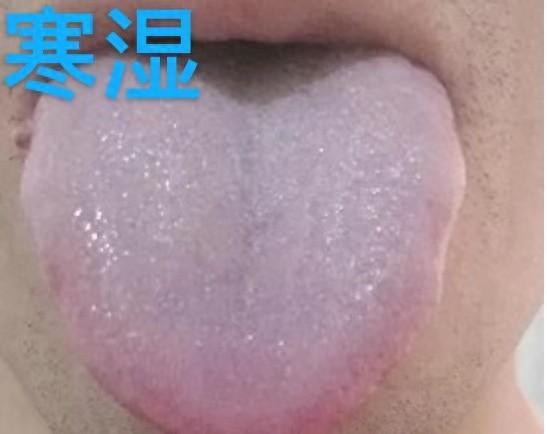 别浪费祛湿“黄金期”——三伏天，分清寒湿、痰湿、湿热是关键！