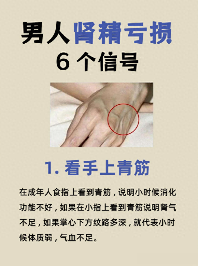 男生肾精亏虚的6个信号，看看你占了几个？